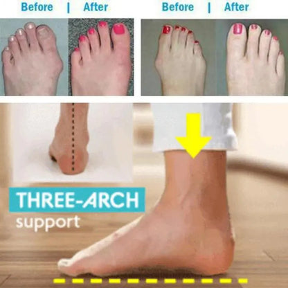 HealthySandals™ Orthopedic Toe Corrector Sandals